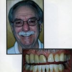 Image of a smiling patient with a close up image of teeth