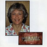 Image of a smiling patient with a close up image of teeth