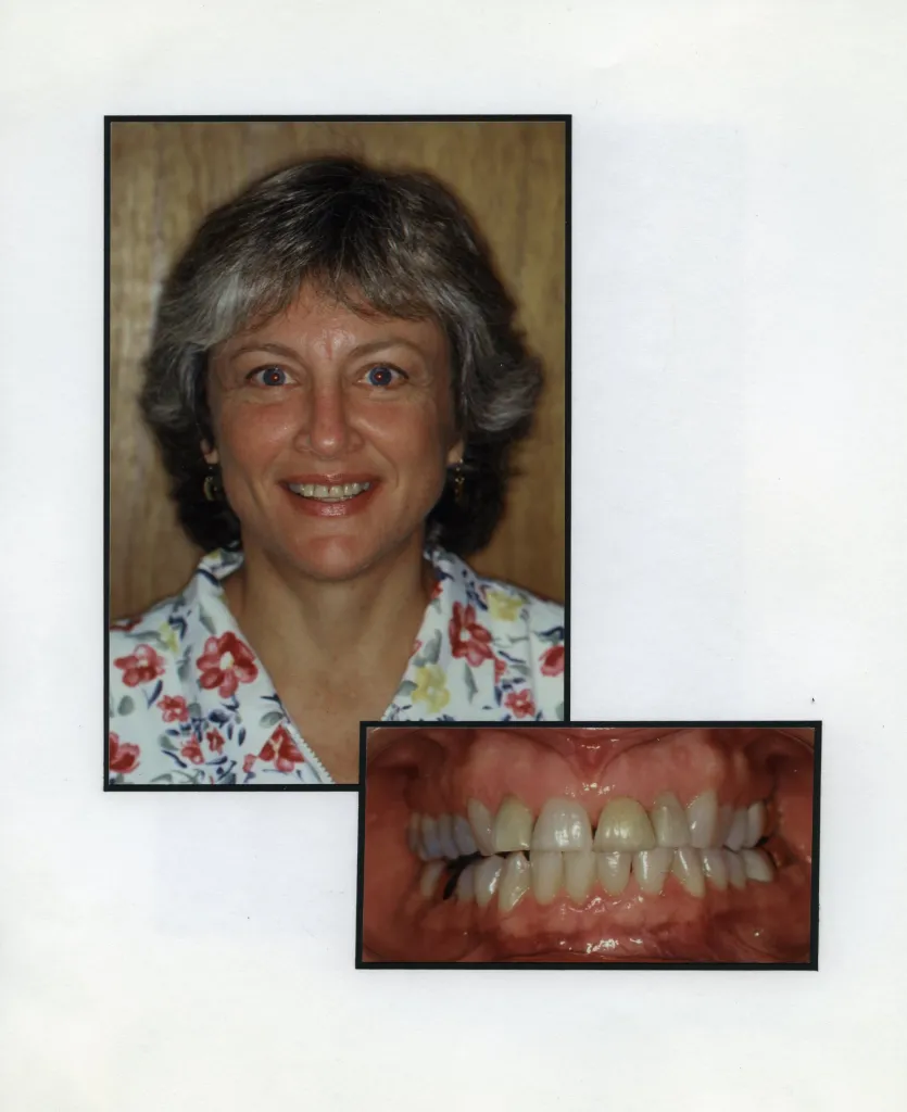 Image of a smiling patient with a close up image of teeth