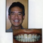 Image of a smiling patient with a close up image of teeth